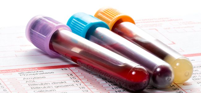 Blood test, blood samples on a laboratory form